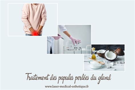 Traitement des papules perlées du gland